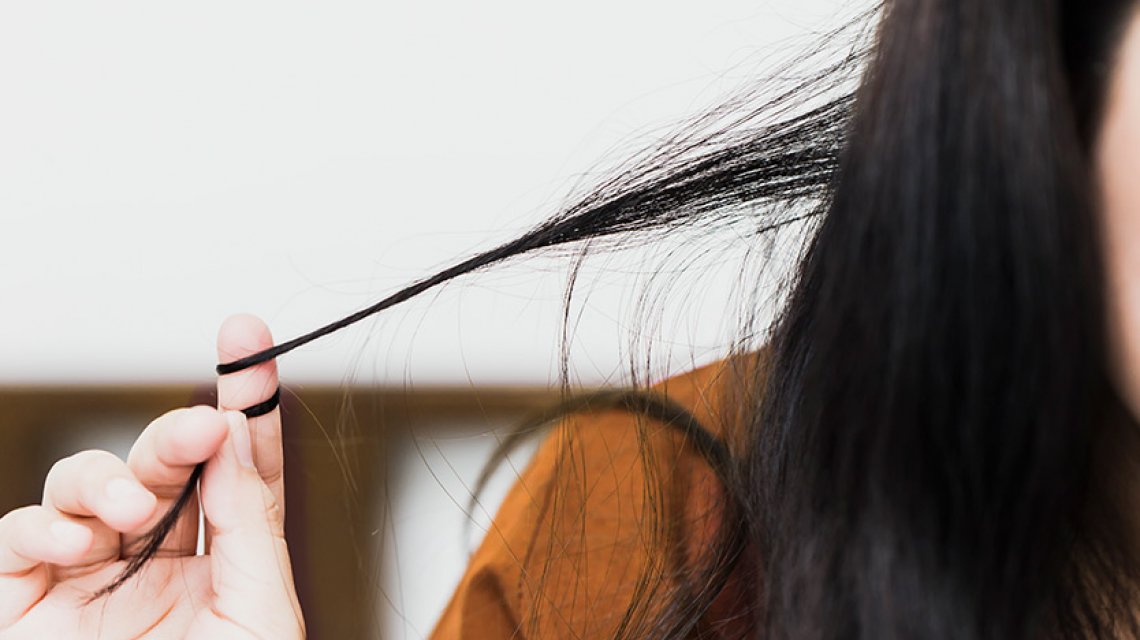Caduta capelli, quando preoccuparsi: la tricotillomania provoca calvizie precoce.