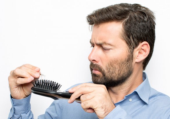 Hair loss, when to worry: inheritance and alopecia