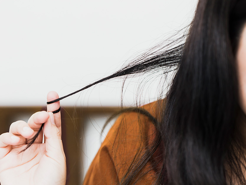 Caduta capelli, quando preoccuparsi: la tricotillomania provoca calvizie precoce.